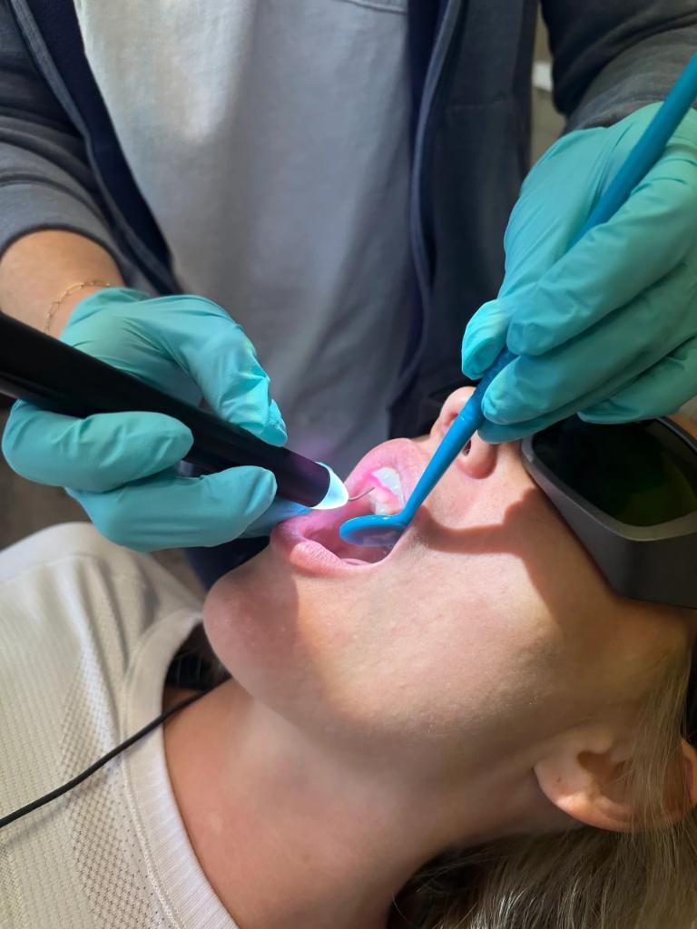 Close-up of dental laser procedure being performed on patient during hands-on certification training